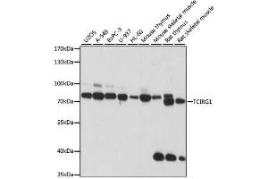 Western blot analysis of extracts of various cell lines, using TCIRG1 antibody. (TCIRG1 antibody)
