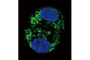 Confocal immunofluorescent analysis of CPT2 Antibody (C-term) (ABIN389105 and ABIN2839295) with HepG2 cell followed by Alexa Fluor 488-conjugated goat anti-rabbit lgG (green). (CPT2 antibody  (C-Term))