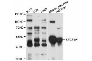 Western blot analysis of extracts of various cell lines, using SEC61A1 antibody.