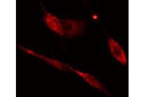 ABIN6274770 staining HeLa cells by IF/ICC. (RPL17 antibody  (C-Term))
