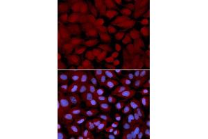 Immunofluorescence analysis of U2OS cells using OGT antibody. (OGT antibody  (AA 857-1036))