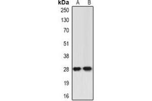 Western blot analysis of ING5 expression in Jurkat (A), A549 (B) whole cell lysates. (ING5 antibody)