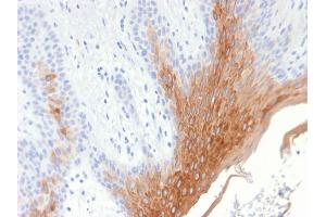 Formalin-fixed, paraffin-embedded human Skin stained with Cytokeratin 10 Rabbit Recombinant Monoclonal Antibody (KRT10/1990R). (Recombinant Keratin 10 antibody)