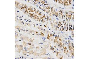 Immunohistochemistry of paraffin-embedded human stomach using BTRC antibody at dilution of 1:200 (x400 lens) (BTRC antibody  (AA 50-340))