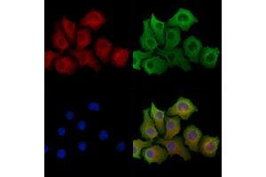 ABIN6264031 and ABIN6278306 staining Hela cells by IF/ICC. (PANX1 antibody  (Internal Region))