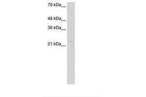 Image no. 2 for anti-Caudal Type Homeobox 4 (CDX4) (AA 181-230) antibody (ABIN6736595) (CDX4 antibody  (AA 181-230))