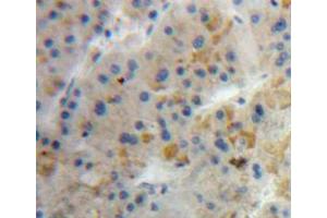 Used in DAB staining on fromalin fixed paraffin-embedded liver tissue (Diazepam Binding Inhibitor antibody  (AA 1-104))