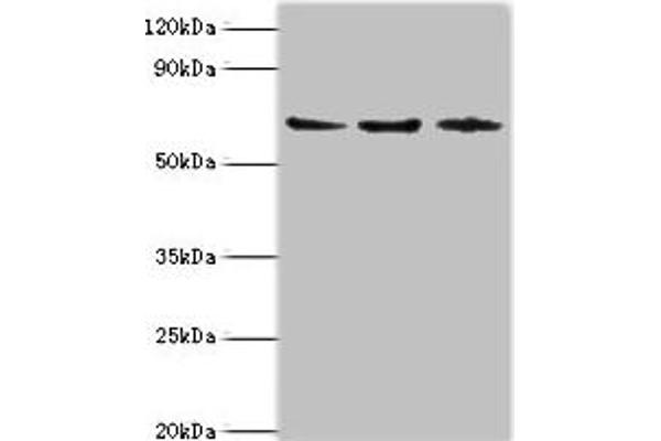 ACAD9 Antikörper  (AA 1-270)
