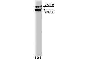 Western blot analysis of Cortactin on a A431 lysate. (Cortactin antibody)