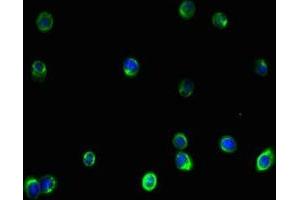 Immunofluorescent analysis of HepG2 cells using ABIN7175511 at dilution of 1:100 and Alexa Fluor 488-congugated AffiniPure Goat Anti-Rabbit IgG(H+L) (Vimentin antibody  (AA 2-466))