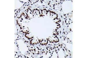 Immunohistochemistry of paraffin-embedded rat lung using Phospho-NRF2-S40 Rabbit mAb (ABIN7268970) at dilution of 1:100 (40x lens). (NRF2 antibody  (pSer40))