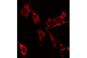 ABIN6275302 staining Hela by IF/ICC. (Neurocan antibody  (Internal Region))