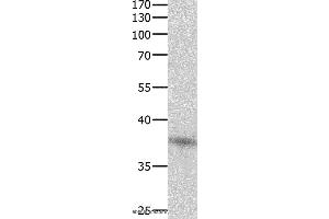Western blot analysis of Jurkat cell , using DUSP12 Polyclonal Antibody at dilution of 1:500 (DUSP12 antibody)