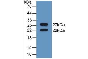 Detection of Recombinant CNX, Mouse using Polyclonal Antibody to Calnexin (CNX) (Calnexin antibody  (AA 263-482))