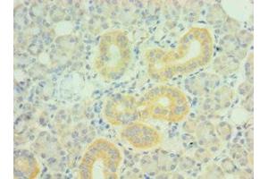 Immunohistochemistry of paraffin-embedded human pancreatic tissue using ABIN7162721 at dilution of 1:100 (PDLIM1 antibody  (AA 1-329))