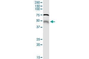 MGRN1 MaxPab rabbit polyclonal antibody. (Mahogunin RING Finger Protein 1 antibody  (AA 1-576))