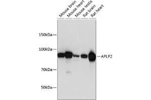 Western blot analysis of extracts of various cell lines, using  Polyclonal Antibody (ABIN6129925, ABIN6136995, ABIN6136996 and ABIN6221112) at 1:1000 dilution. (APLP2 antibody  (AA 340-450))