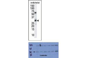 TOP: The anti-DSCR1 Pab is used in Western blot to detect DSCR1 in endothelial tissue lysate. (RCAN1 antibody  (C-Term))