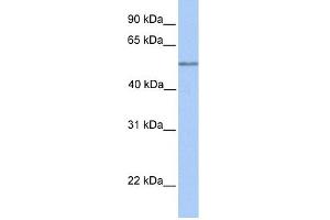 WB Suggested Anti-C17orf74 Antibody Titration: 0. (C17orf74 antibody  (Middle Region))