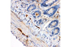Anti- IRS1 antibody, IHC(P) IHC(P): Rat Intestine Tissue (IRS1 antibody  (AA 1041-1242))