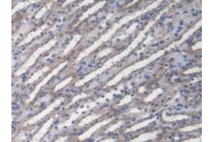 Figure. (DNAJC2 antibody  (AA 368-621))