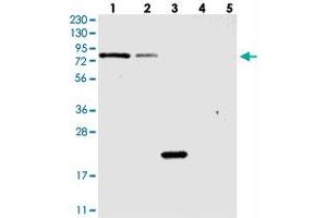Western blot analysis of Lane 1: RT-4, Lane 2: U-251 MG, Lane 3: Human Plasma, Lane 4: Liver, Lane 5: Tonsil with PGBD2 polyclonal antibody  at 1:250-1:500 dilution. (PGBD2 antibody)