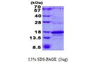 Figure annotation denotes ug of protein loaded and % gel used. (CD247 Protein)
