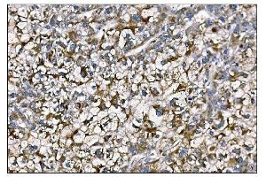 IHC analysis of MERTK using anti-MERTK antibody (ABIN7600623).