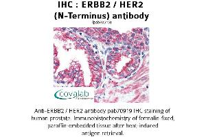 Image no. 1 for anti-Receptor tyrosine-protein kinase erbB-2 (ErbB2/Her2) (Extracellular Domain), (N-Term) antibody (ABIN1734114) (ErbB2/Her2 antibody  (Extracellular Domain, N-Term))