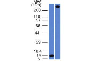 Western Blot Analysis A) Recombinant Protein (B) human lung lysate Using VWF Mouse Monoclonal Antibody (VWF/1465). (VWF antibody  (AA 1815-1939))