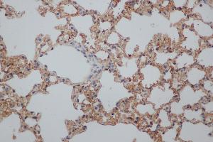 Immunohistochemistry (IHC) image for anti-Natural Killer Cell Receptor 2B4 (CD244) antibody (ABIN5959143) (2B4 antibody)
