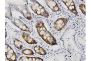 Immunoperoxidase of monoclonal antibody to CDC2 on formalin-fixed paraffin-embedded human small Intestine. (CDK1 antibody  (AA 1-297))