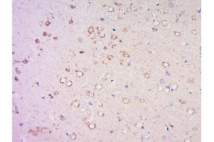 Paraformaldehyde-fixed, paraffin embedded rat brain, Antigen retrieval by boiling in sodium citrate buffer (pH6) for 15min, Block endogenous peroxidase by 3% hydrogen peroxide for 30 minutes, Blocking buffer (normal goat serum) at 37°C for 20min, Antibody incubation with Rabbit Anti-DNA Polymerase iota Polyclonal Antibody, Unconjugated  at 1:500 overnight at 4°C, followed by a conjugated secondary for 90 minutes and DAB staining. (POLI antibody  (AA 51-150))