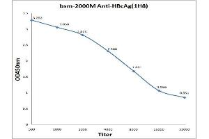 Hepatitis B Virus Core Antigen (HBcAg) antibody