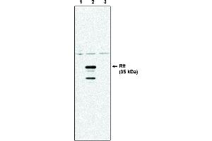 Western blot analysis using Rit antibody . (RIT1 antibody)