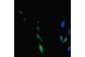 Immunofluorescent analysis of Hela cells using ABIN7171733 at dilution of 1:100 and Alexa Fluor 488-congugated AffiniPure Goat Anti-Rabbit IgG(H+L) (TRF2 antibody  (AA 78-238))