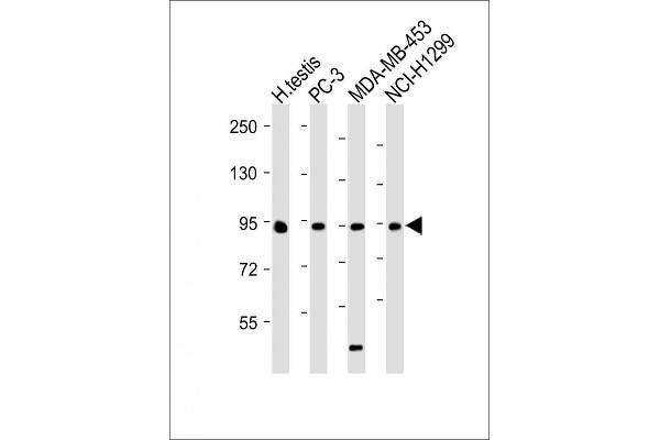 BRDT antibody  (N-Term)