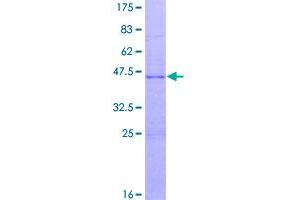 Image no. 1 for Insulin-Like Growth Factor 1 (IGF1) (AA 1-153) protein (GST tag) (ABIN1307542)