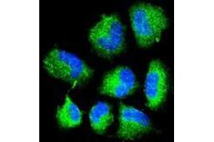 Confocal immunofluorescent analysis of CHAT Antibody (N-term) with NCI-H460 cell followed by Alexa Fluor® 488-conjugated goat anti-rabbit lgG (green). (Choline Acetyltransferase antibody  (N-Term))