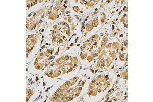 Immunohistochemistry of paraffin-embedded human stomach using PLK1 antibody at dilution of 1:200 (x400 lens)