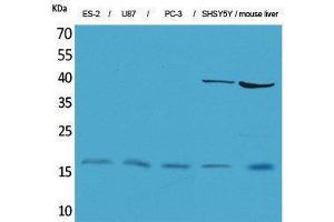 Western Blotting (WB) image for anti-Interleukin 1, beta (IL1B) (Internal Region) antibody (ABIN3187737) (IL-1 beta antibody  (Internal Region))