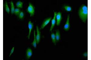 Immunofluorescence staining of Hela cells with ABIN7152698 at 1:266, counter-stained with DAPI. (FERMT1 antibody  (AA 321-420))