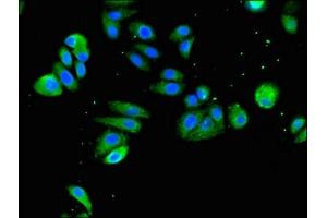 Immunofluorescent analysis of HepG2 cells using ABIN7171115 at dilution of 1:100 and Alexa Fluor 488-congugated AffiniPure Goat Anti-Rabbit IgG(H+L) (SLC18A2 antibody  (AA 463-514))