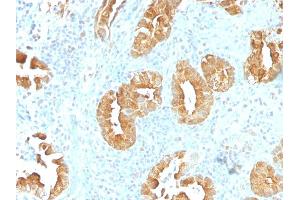 Formalin-fixed, paraffin-embedded human Rectum stained with Villin Monoclonal Antibody (VIL1/1314).