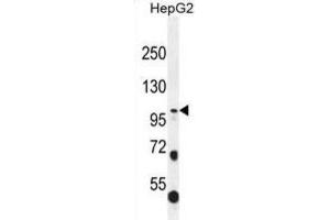 Western Blotting (WB) image for anti-Collagen, Type XXI, alpha 1 (COL21A1) antibody (ABIN2996551) (COL21A1 antibody)
