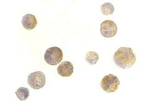 Immunocytochemistry of TACI in K562 cells with this product at 2 μg/ml. (TACI antibody  (N-Term))