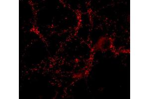 Indirect immunostaining of PFA fixed hippocampus neurons (dilution 1 : 500). (CASKIN1 antibody)