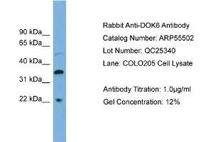 WB Suggested Anti-DOK6  Antibody Titration: 0. (DOK6 antibody  (Middle Region))