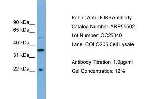 WB Suggested Anti-DOK6  Antibody Titration: 0.