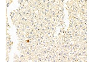 anti-Guanidinoacetate N-Methyltransferase (GAMT) (Internal Region) antibody